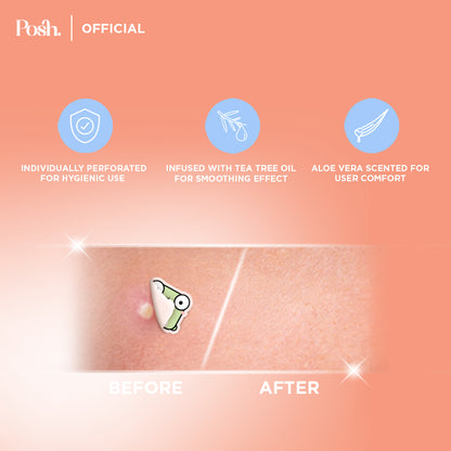 Frog - 24 Pack Pimple Patch