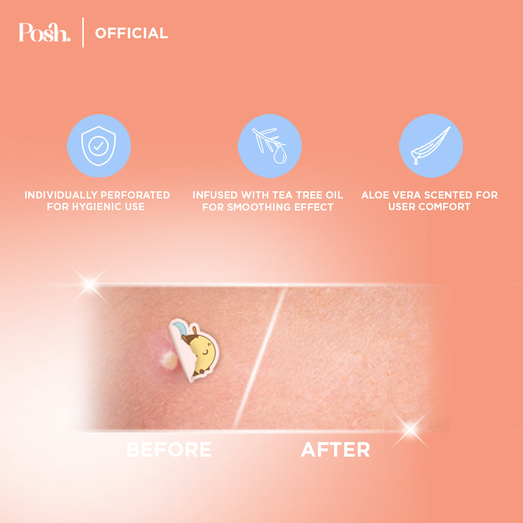 Bumble Bee - 24 Pack Pimple Patch