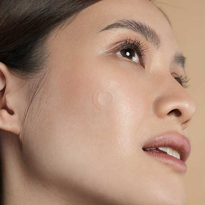 Microneedle - 9 Pack Pimple Patch