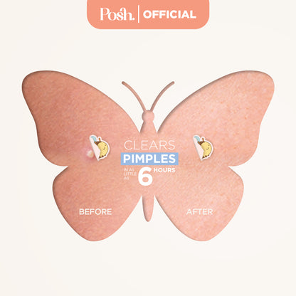 Black & White - 32 Pack Pimple Patch